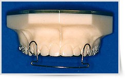 Visione frontale arco III cl